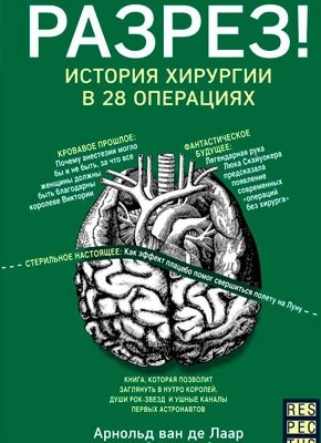 Разрез! История хирургии в 28 операциях. Арнольд Ван Де Лаар